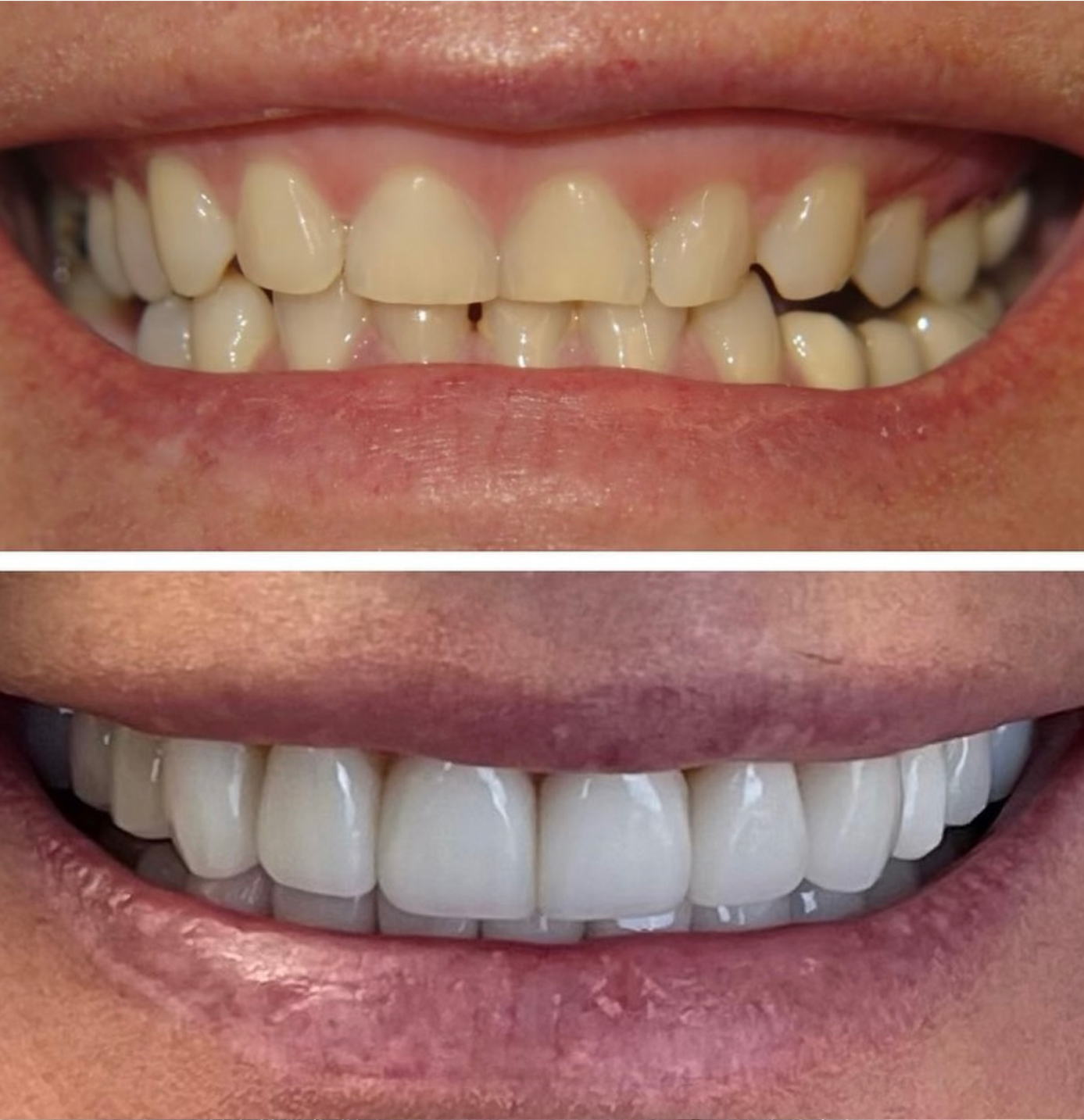 tulsa cosmetic dentist