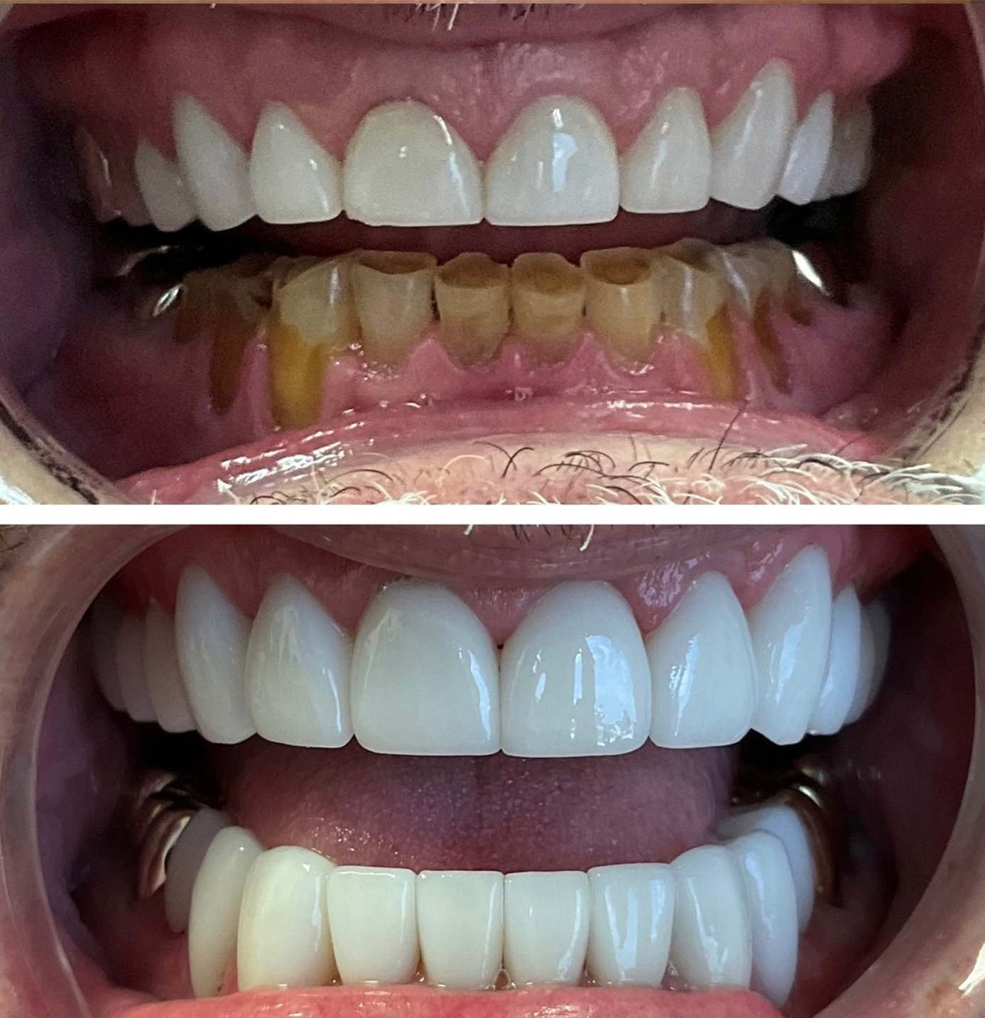 tulsa cosmetic dentist