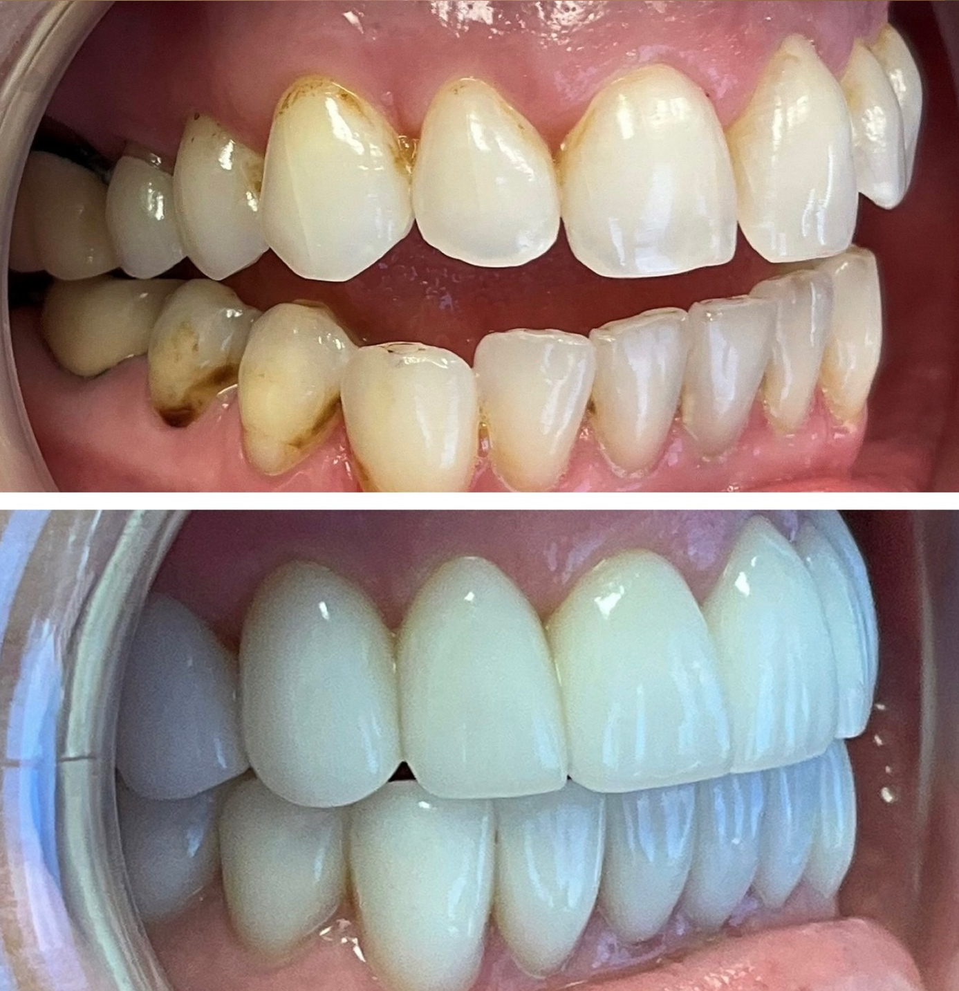 tulsa cosmetic dentist