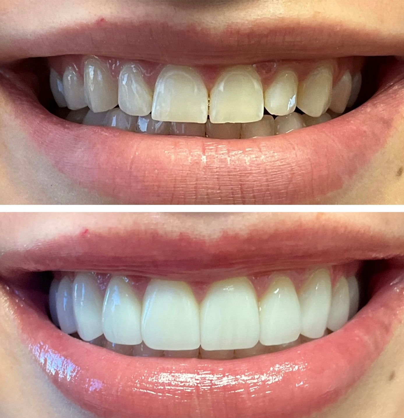 tulsa cosmetic dentist