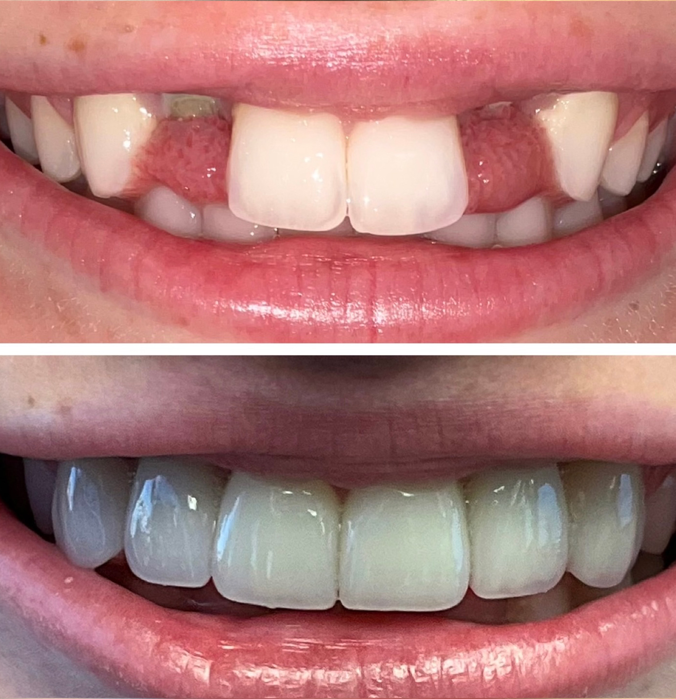 tulsa cosmetic dentist