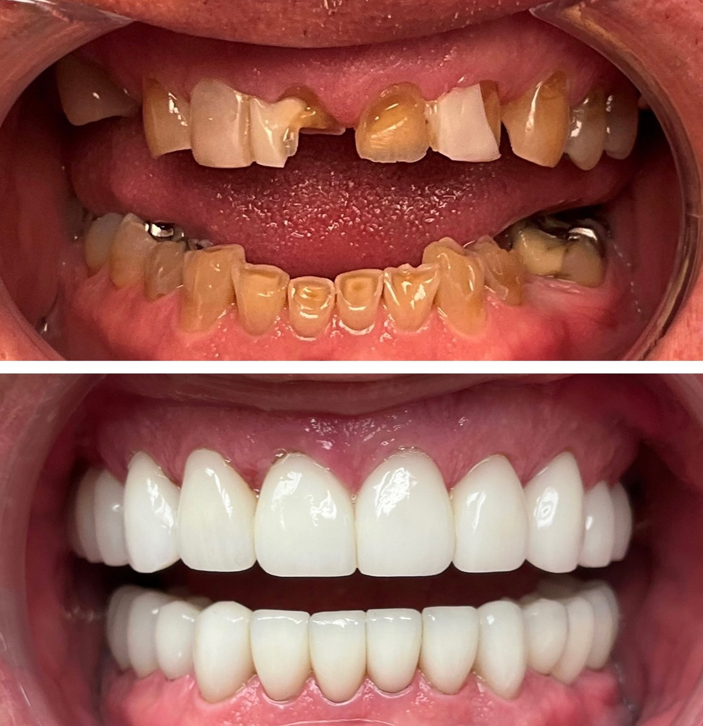 tulsa cosmetic dentist