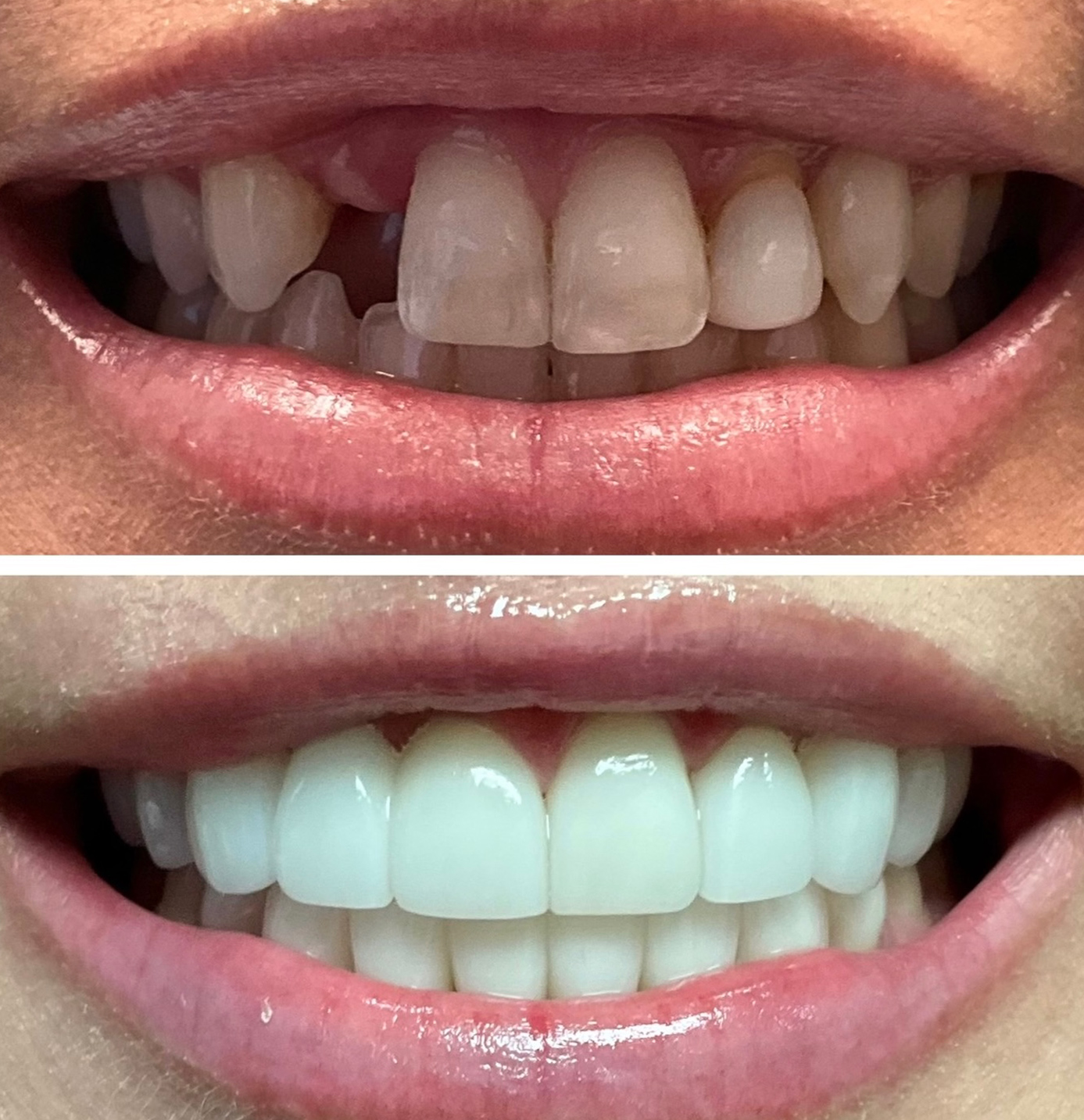 tulsa cosmetic dentist