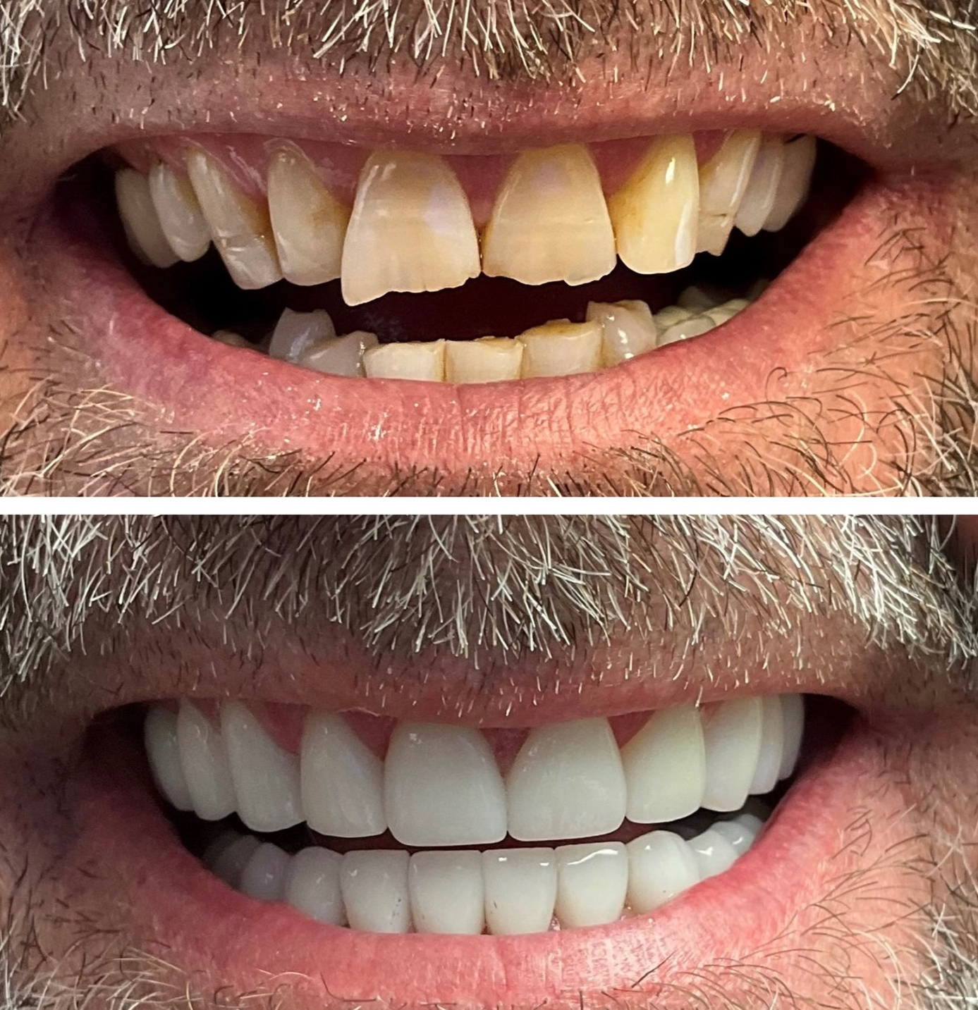 tulsa cosmetic dentist