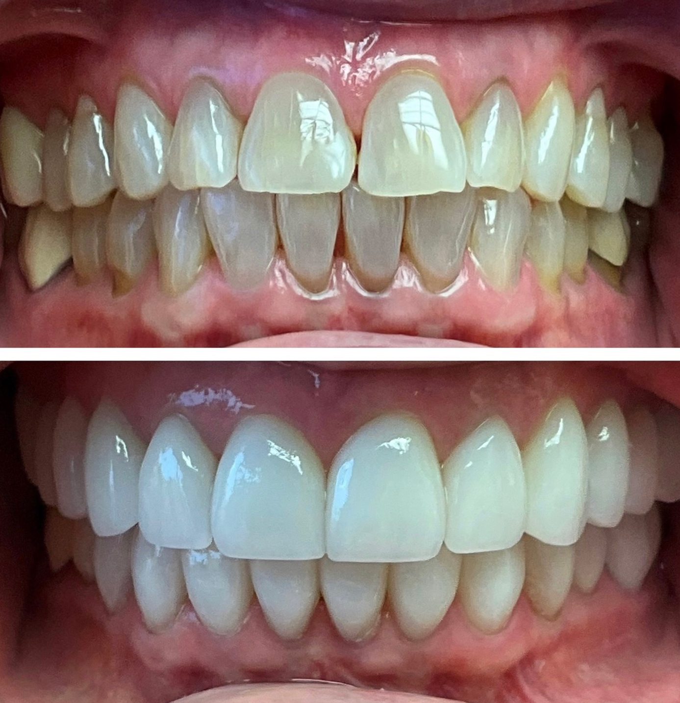 tulsa cosmetic dentist