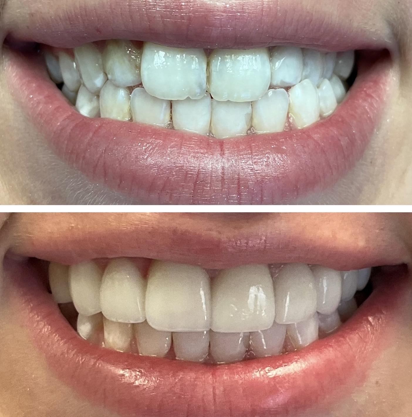 tulsa cosmetic dentist