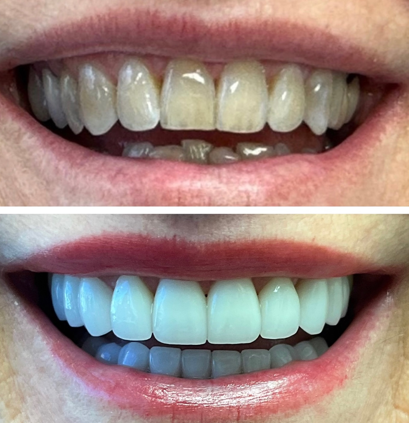 tulsa cosmetic dentist