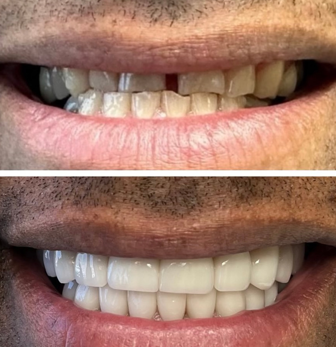 tulsa cosmetic dentist