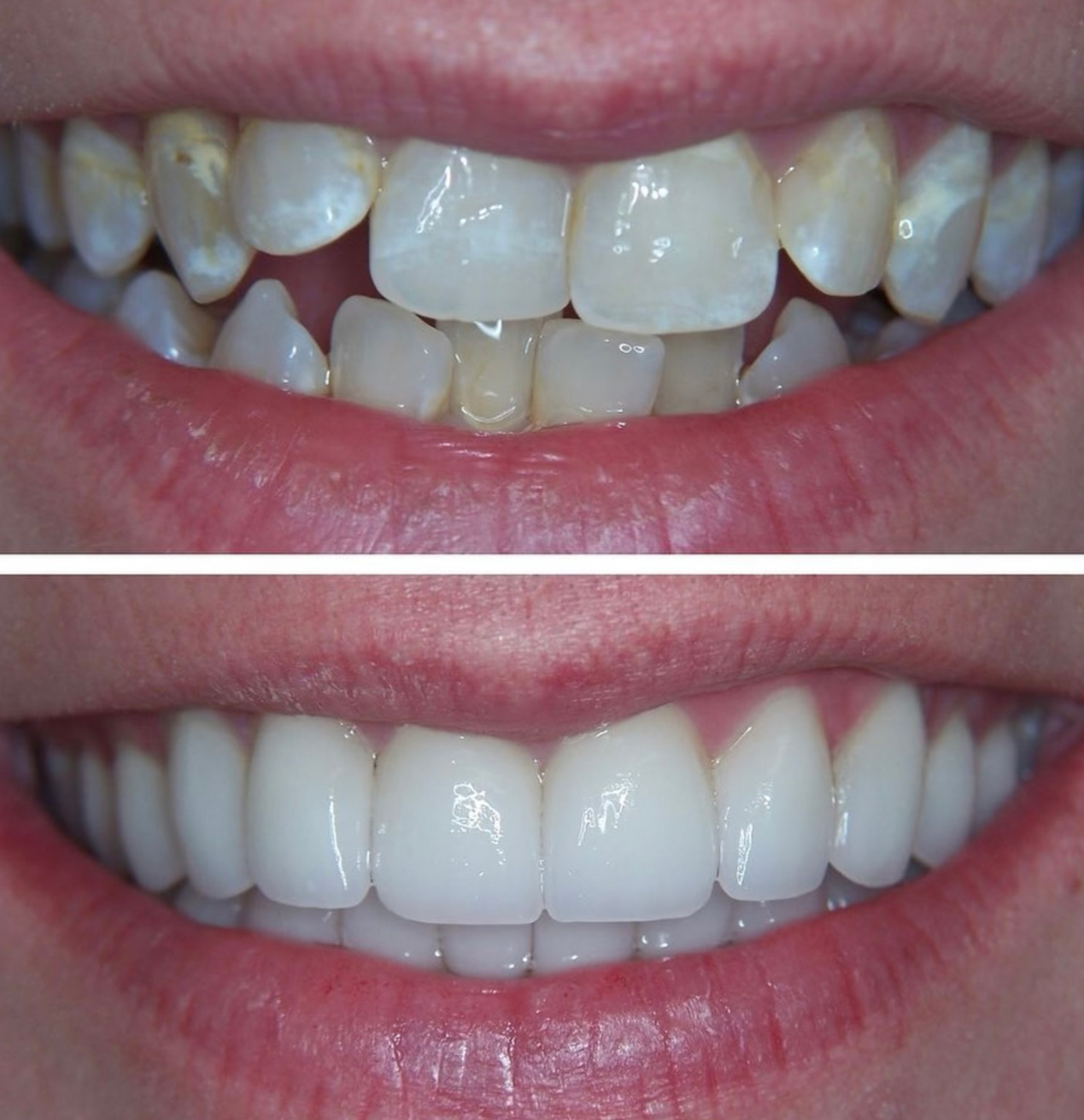 tulsa cosmetic dentist