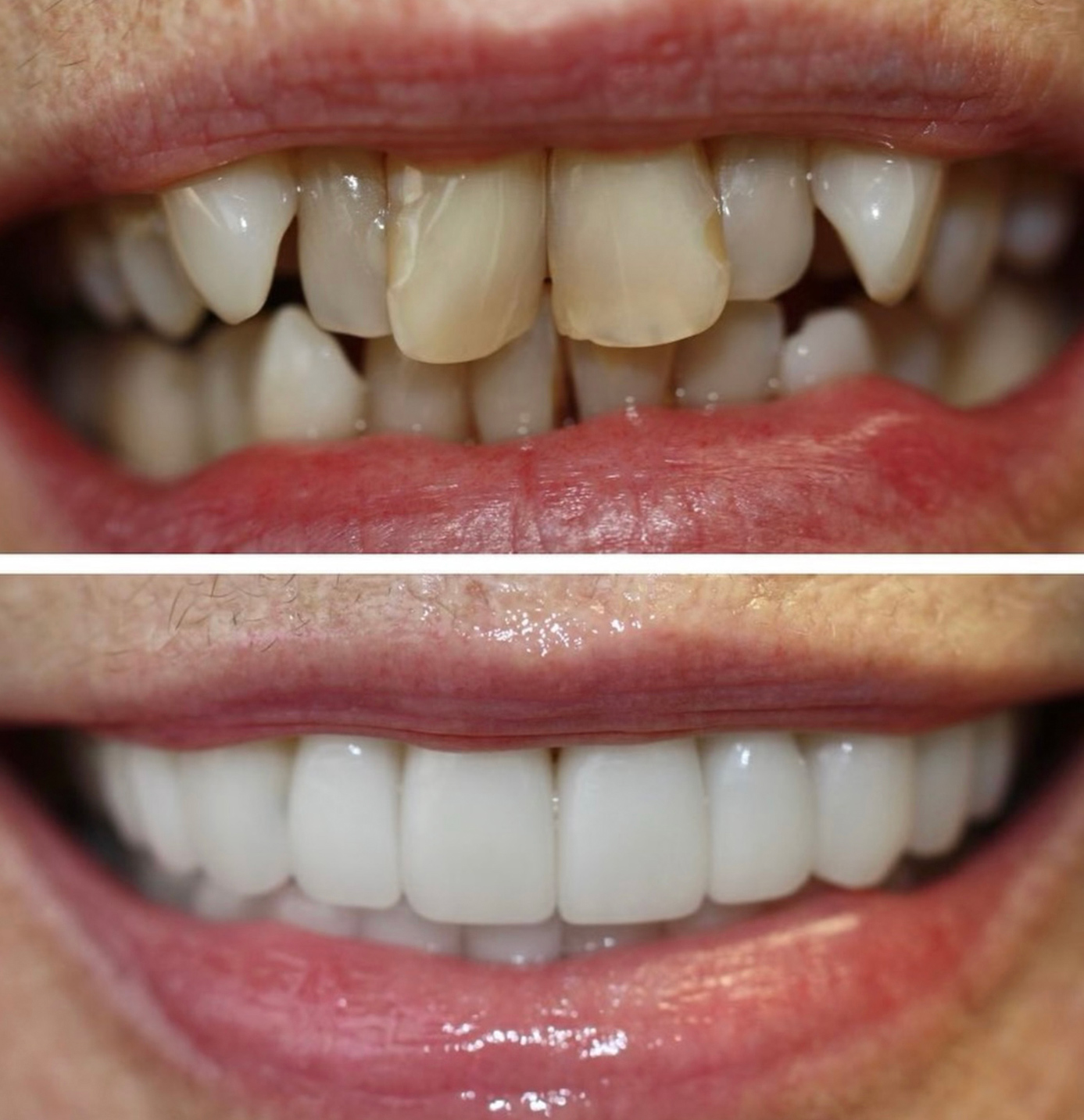tulsa cosmetic dentist