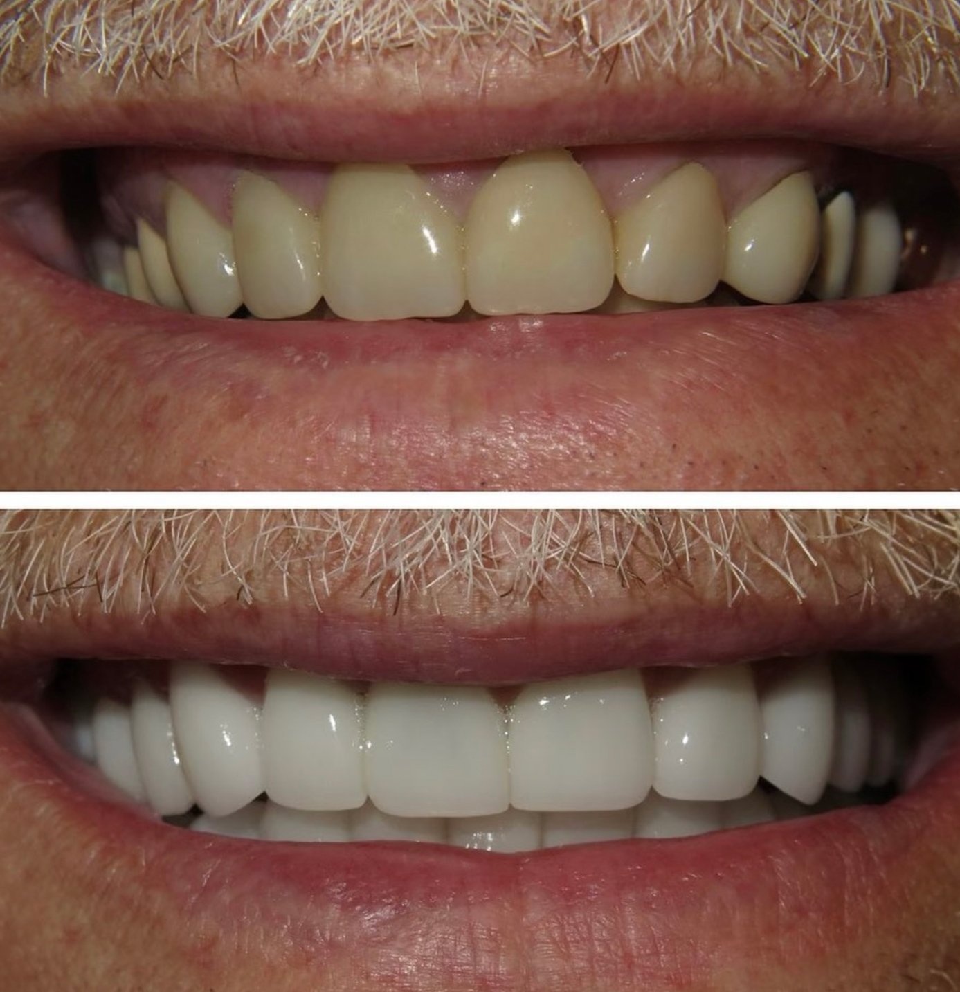 tulsa cosmetic dentist