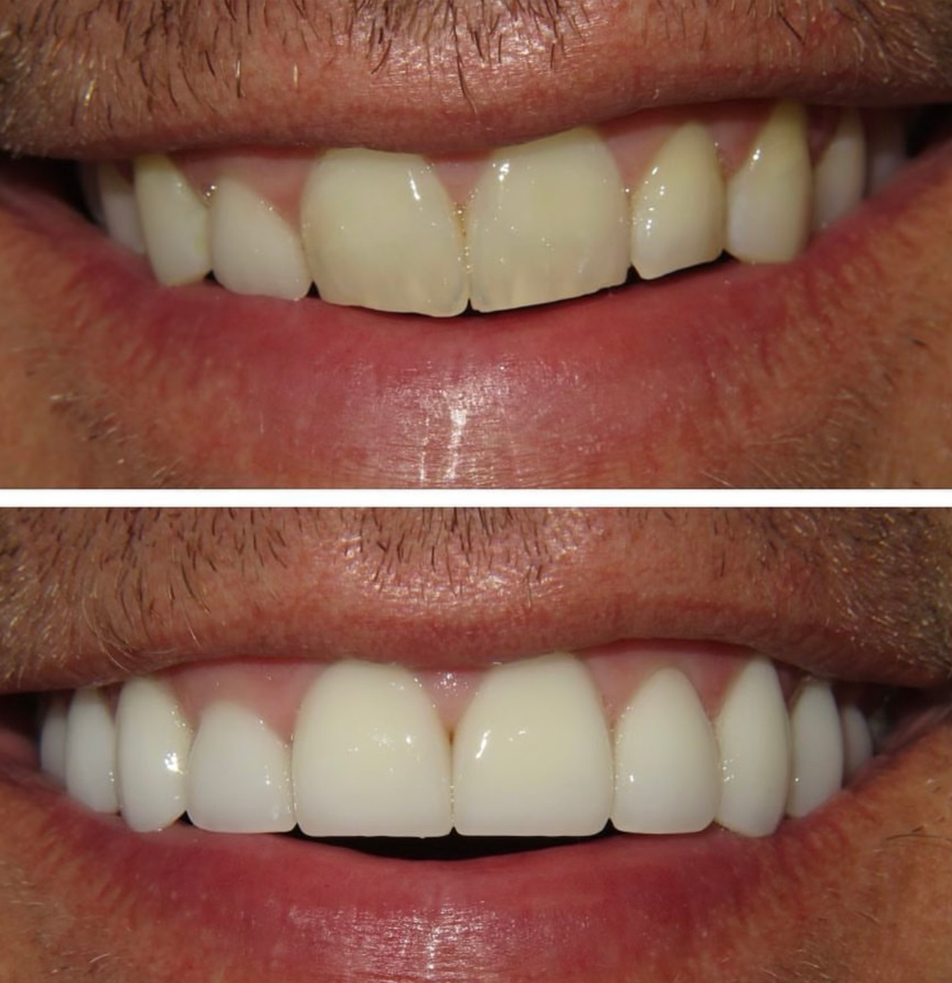 tulsa cosmetic dentist